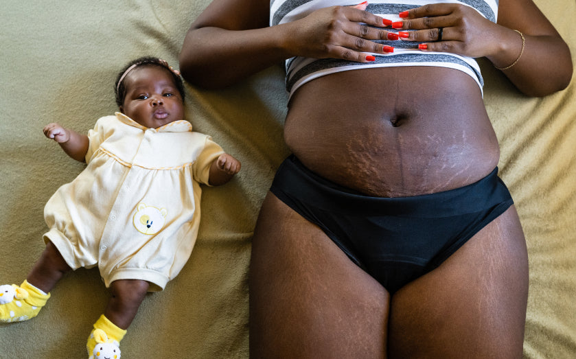Everything you need to know about postpartum bleeding Postpartum – Modibodi  EU